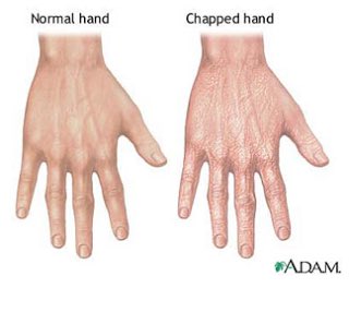 IndyLotionClub's tweet photo. Indy vs. Summit hands #loshnation https://t.co/UN2TIqZdJS