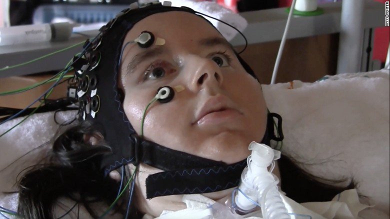 cnni's tweet photo. This brain-computer system could help to decipher the thoughts of completely locked-in patients who can't even blink https://t.co/7mrTwMwdfs https://t.co/OwuBJlcxZf