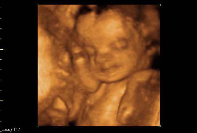 LilRimaAngel's tweet image. Unborn baby girl to @CRISSANGELPR @MissUSAWWE