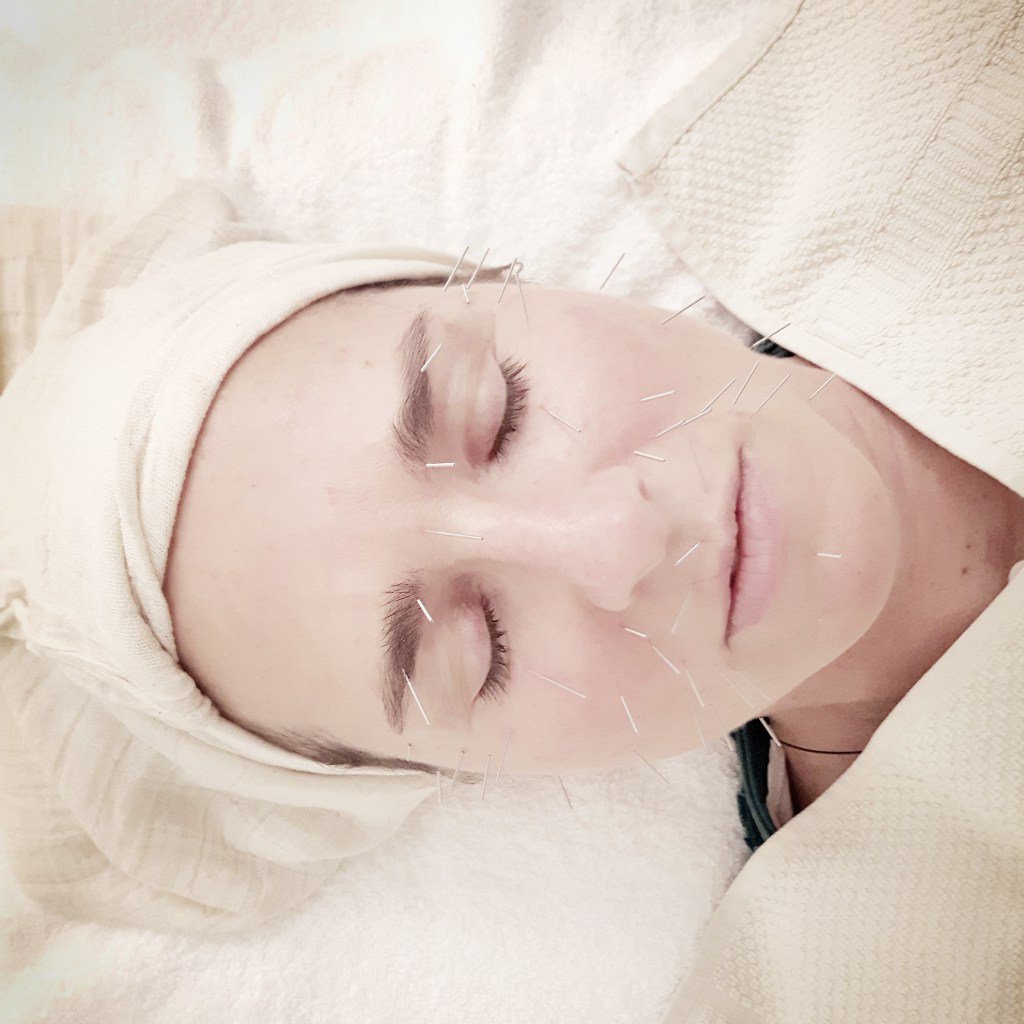 Lifting sense cirurgia. Cuidem la pell amb Medicina Xinesa naturalisaludable.wordpress.com/2017/02/01/lif…