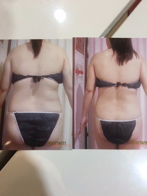 getlady1216's tweet photo. メディセル5回終了後!体の丸みはとれ、細く小さくなってる!
『切らない脂肪吸引』『筋膜リリース』是非ご体験あれ!
#広島県 #福山市 #結果を出すなら #GetLady #ダイエット #メディセル #筋膜リリース #切らない脂肪吸引
https://t.co/HO3nzUwQg8 https://t.co/v8iOIeQeN9