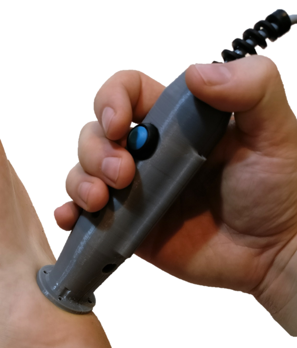 ReSolve_RE's tweet photo. #electrochemistry could be a viable option for objectively assessing biological tissues - https://t.co/CGzEJBZjnP @PeteCulmer @IMPRESSleeds https://t.co/gsnGS3GQ2e