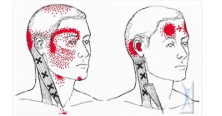Missing this #vitamin in your diet is causing you #migraines! #Health #HealthTips #HealthyLiving via <a href="/naturalnfit/">naturalnfit</a> naturalnfit.com/missing-vitami…