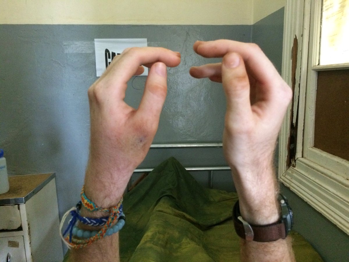 LeviticusMax's tweet photo. So here's a fun story about me getting bit by a snake in Mozambique this month, more blogs to come soon!! https://t.co/0juzeawnbl https://t.co/j9j3aKfTgg