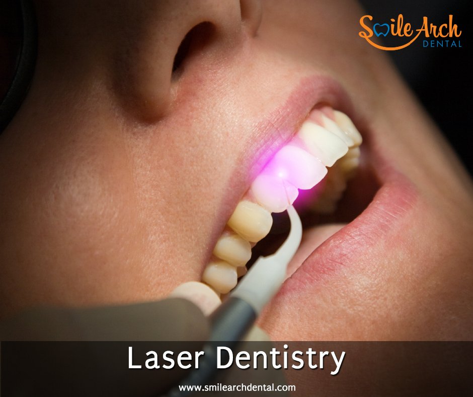 Lasers can be used to remove a small piece of tissue. so that it can be examined for cancer. Lasers are used teeth whitening, Gum disease.