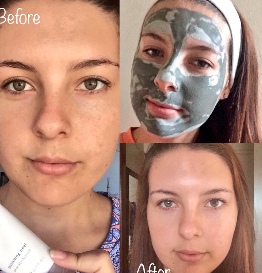 RCSCity's tweet image. This is a amazing polishing peel! Why pay for a salon when you can get great results at home #beauty