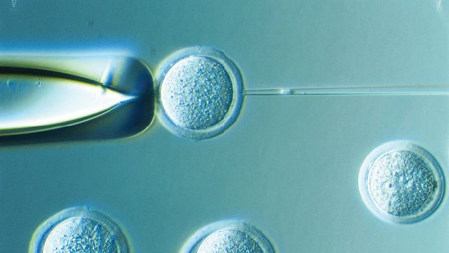 TheScientistLLC's tweet photo. ICYMI: Opinion - Ethical Considerations of “Three-Parent” Babies https://t.co/SQxOcxpvaz https://t.co/wakNkm50Ap