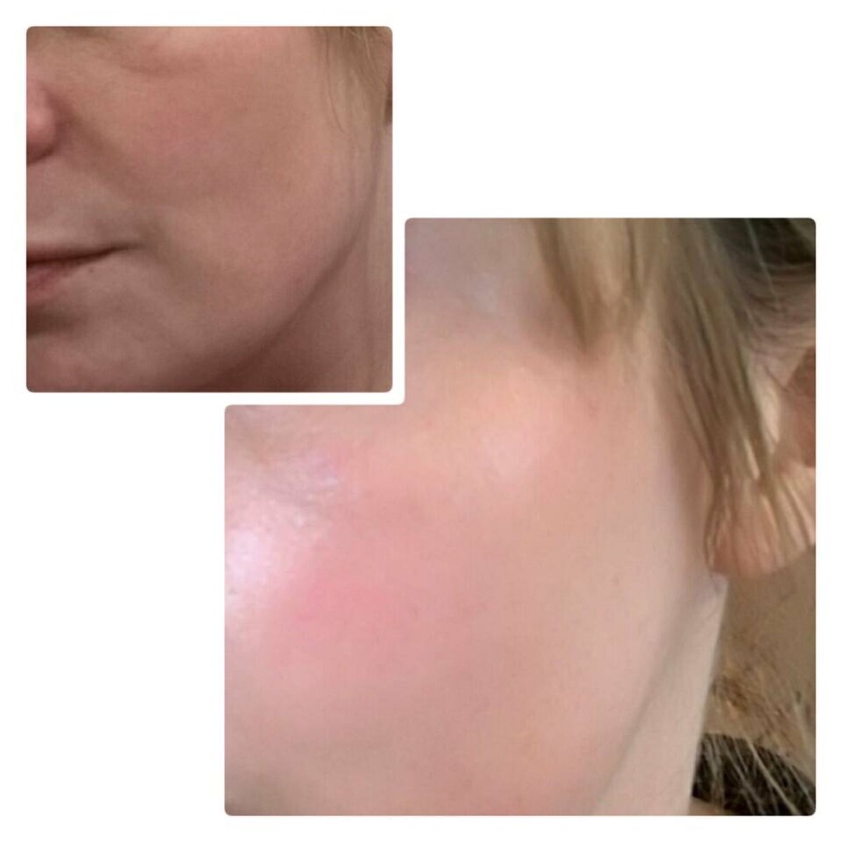 LuloBeauty's tweet photo. The polish peel working wonders yet again. Results are similar to microdermabrasion in a bottle! flash sale until 10pm this evening https://t.co/m0e2IOKTCU