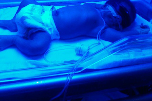 MsBrefo's tweet photo. $15,000 is needed for surgery for Gregory. #SaveGregory https://t.co/dFF6pU9Vdq