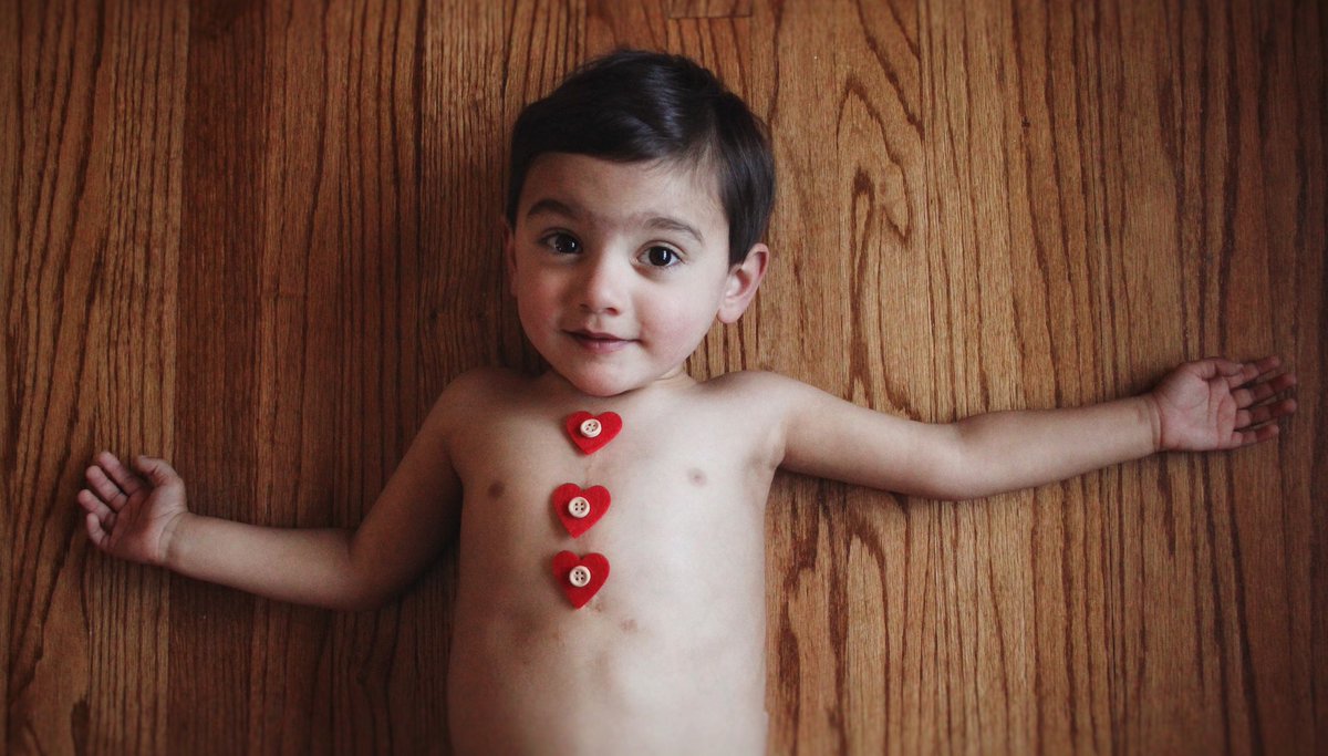aliranger29's tweet photo. Brave, broken, beautiful. February is heart month, and mine beats for his.
#CHDawareness #heterotaxy #heterotaxyconnection #heartmonth https://t.co/NWrvd8KeZk