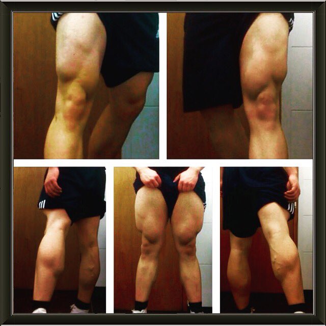 craigls1993's tweet photo. LEG DAY!! My second favourite day of the week!!! #legs #legday #bodybuildin #progress #battered #calfs #quads @CLSFITNESSUK https://t.co/4TDYMGkcUL