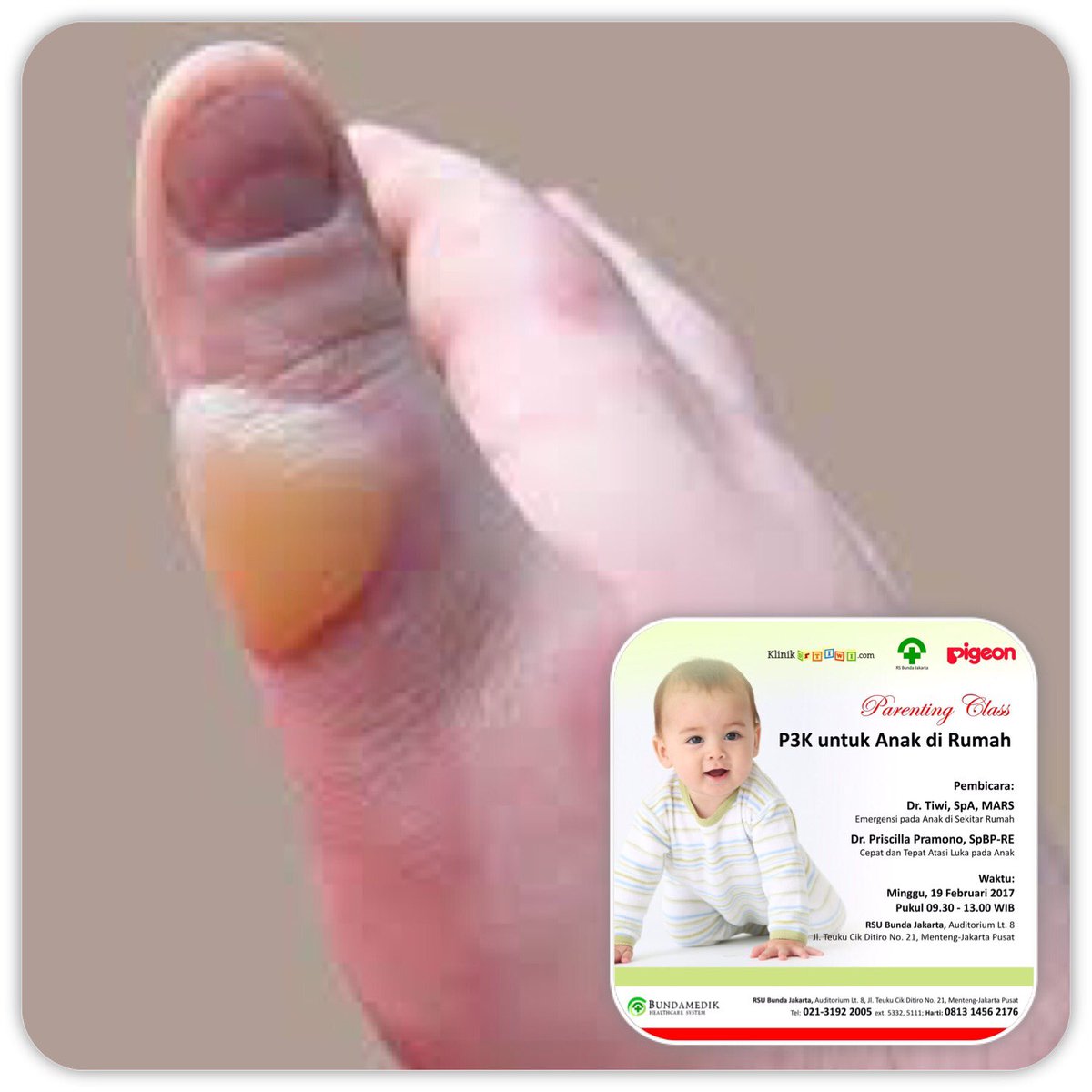 Si kecil tersiram air panas...segera BILAS! Bukan diolesi mentega/odol/lotion ya. Lengkapnya ada di parenting class <a href="/drtiwi/">dr ayu partiwi</a> ! Cc <a href="/LiesKum2/">Lies Setyarini</a>