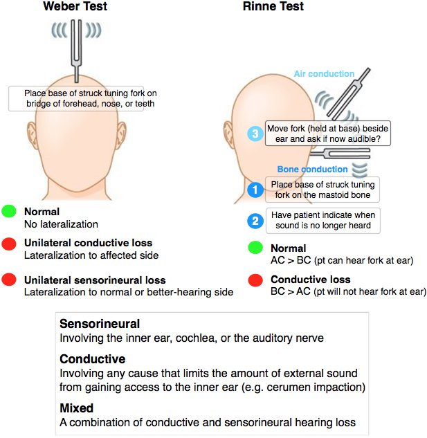 weber test positive