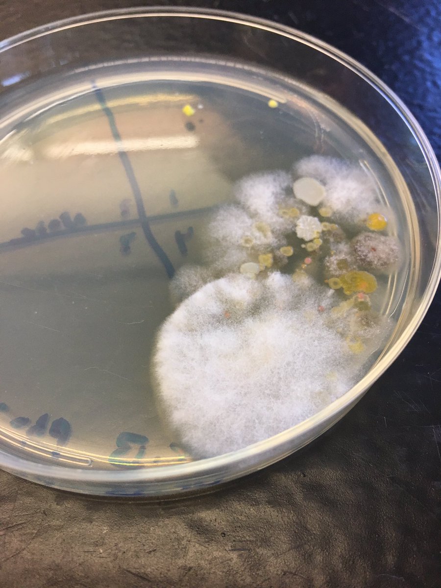 bennettmadison3's tweet photo. Microscopic and aerial photo on the microbes on Dr. Belford's J's y'all. @MMCBiology #microbes #nutrientagar https://t.co/KxRTDuD4om