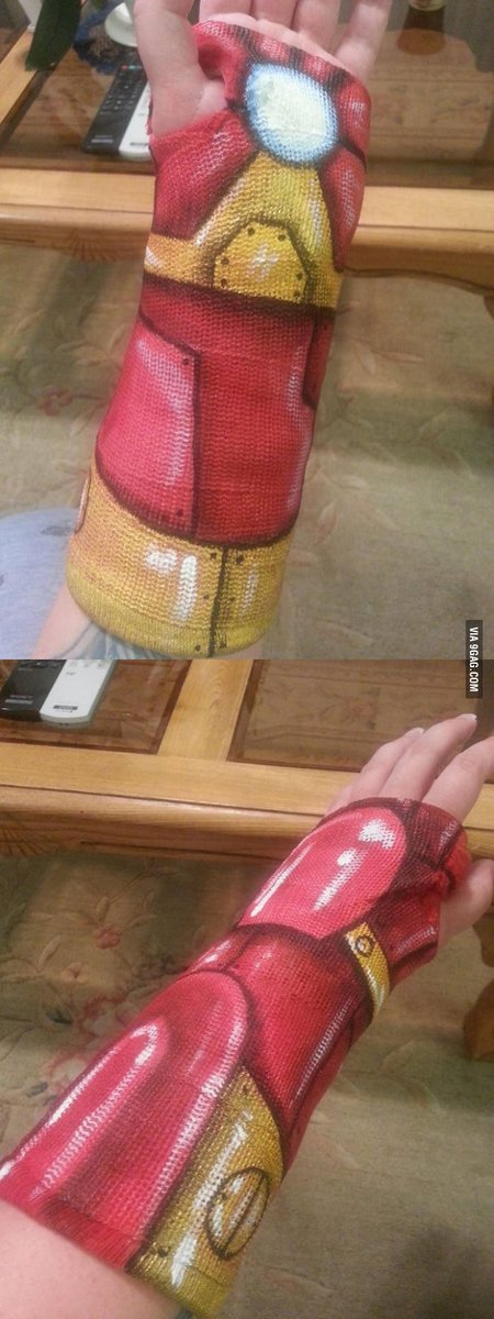 DirectOrthoCare's tweet photo. You know what's not cool? Breaking your arm.
You know what IS cool? Suddenly becoming Iron Man. #DOC #GoSeeDOC https://t.co/2g5RDIKFfi