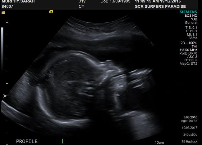 So instead of launching Resplendent mid this year it will now be mid next year as this little guy has decided to make his appearance in May