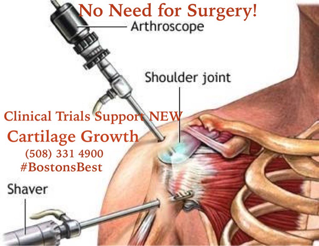 NEModeling's tweet photo. #nosurgery try our #procosa and feel the difference. #rotatorcuff #kneereplacement https://t.co/AhqhZRzdRn
