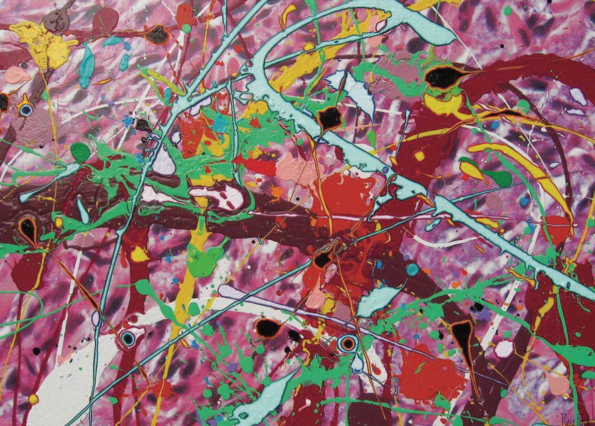 SamMcCashPath's tweet photo. The Healing Art of Pathology. https://t.co/XpLEv1UiIp https://t.co/K0DLYSRpyJ
