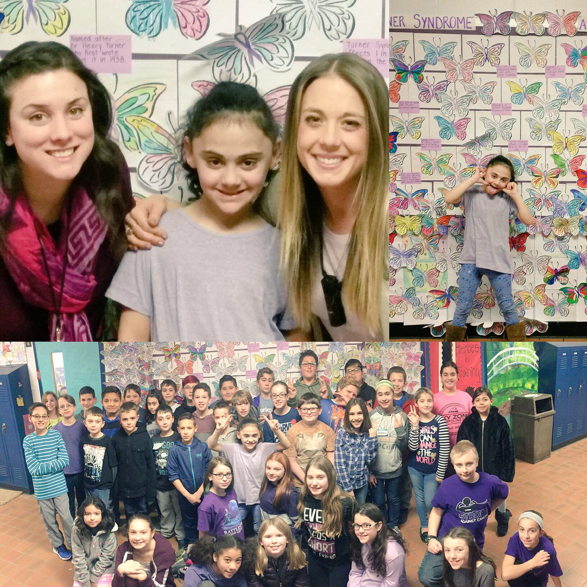 ErnstMPS's tweet photo. Supporting one of our own!#turnersyndrome day at the Pond @reb_fielding @PrincipalMPES https://t.co/NIYX0IO0JY