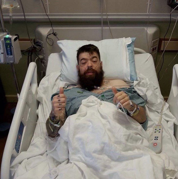 Strange Famous Records (@sfrupdates) on Twitter photo 2 big thumbs up to Runt of <a href="/JivinScientists/">Jivin Scientists</a>. After 6 hrs of surgery, Runt & his dad are doing well! #LivingDonorLife instagram.com/p/BQltKvJByXK/… 2 big thumbs up to Runt of <a href="/JivinScientists/">Jivin Scientists</a>. After 6 hrs of surgery, Runt & his dad are doing well! #LivingDonorLife instagram.com/p/BQltKvJByXK/…