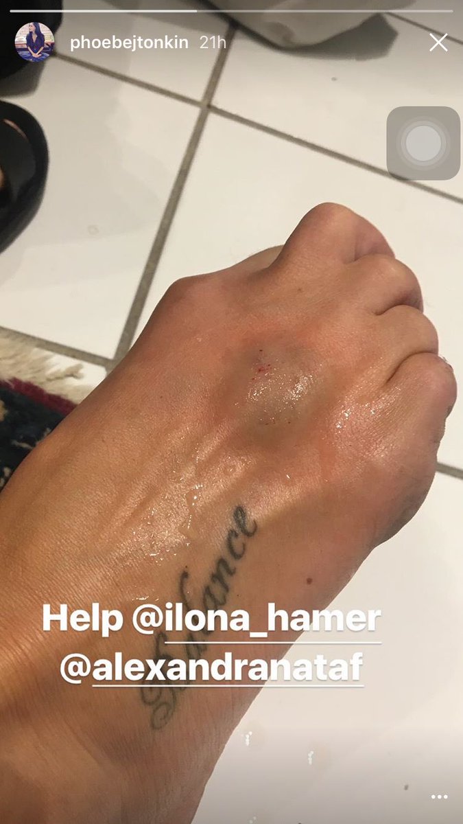 PipeskinBR's tweet photo. 🆕 || Última atualização de Phoebe em seu IG Story. https://t.co/Ds6dwgeklc