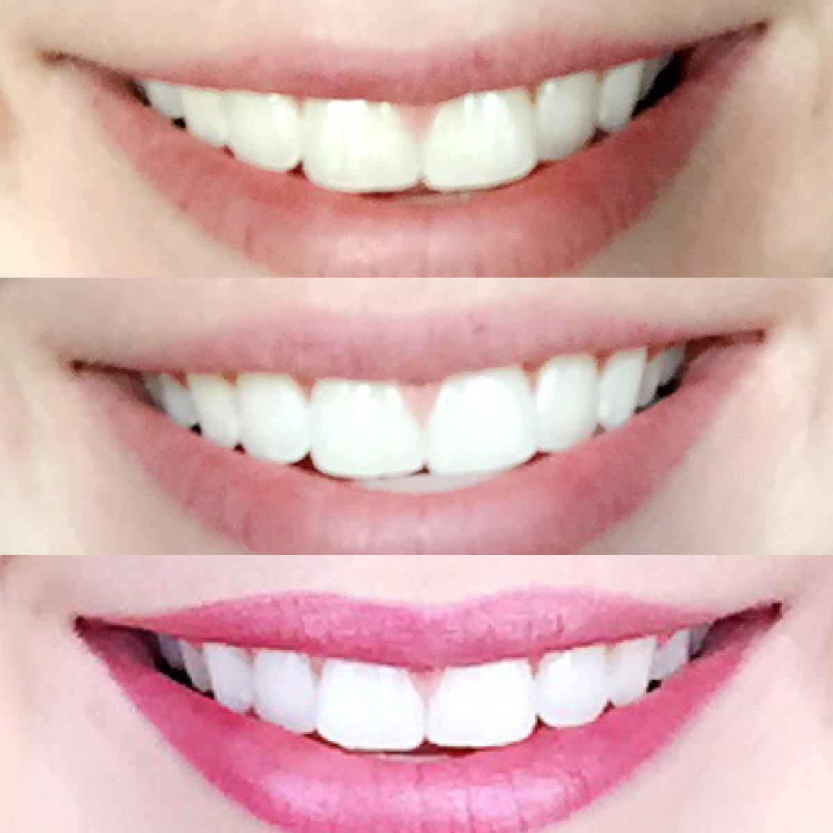 501Centryl's tweet photo. We are a distributor for the AP 24 toothpaste! These results are after ONLY TWO brushes! Message us your email to purchase. $20 + $3 shipped https://t.co/c8lhMjxQSV