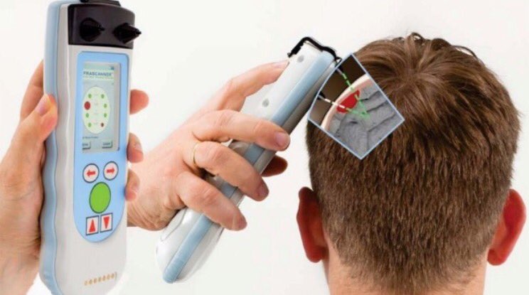 instructoremtp's tweet photo. EMS cutting edge for head injuries - new handheld device takes 2 min to use and detects for intracranial bleeds
 #Gatheringeagles17 https://t.co/ZSGt7DoPHi