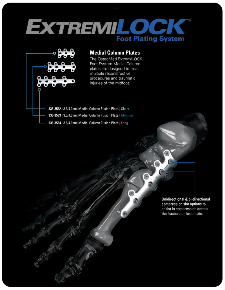 OsteoMedSOURCE's tweet photo. #ExtremiLOCK Foot System #MedialColumn plates are designed to treat multiple reconstructive injuries of the midfoot. https://t.co/2YuMyLdJNb https://t.co/pVjUCGf1mP