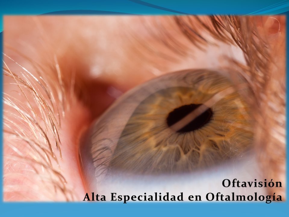 La Retina, protagonista de 2017

oftavision.com.mx/la-retina-prot…