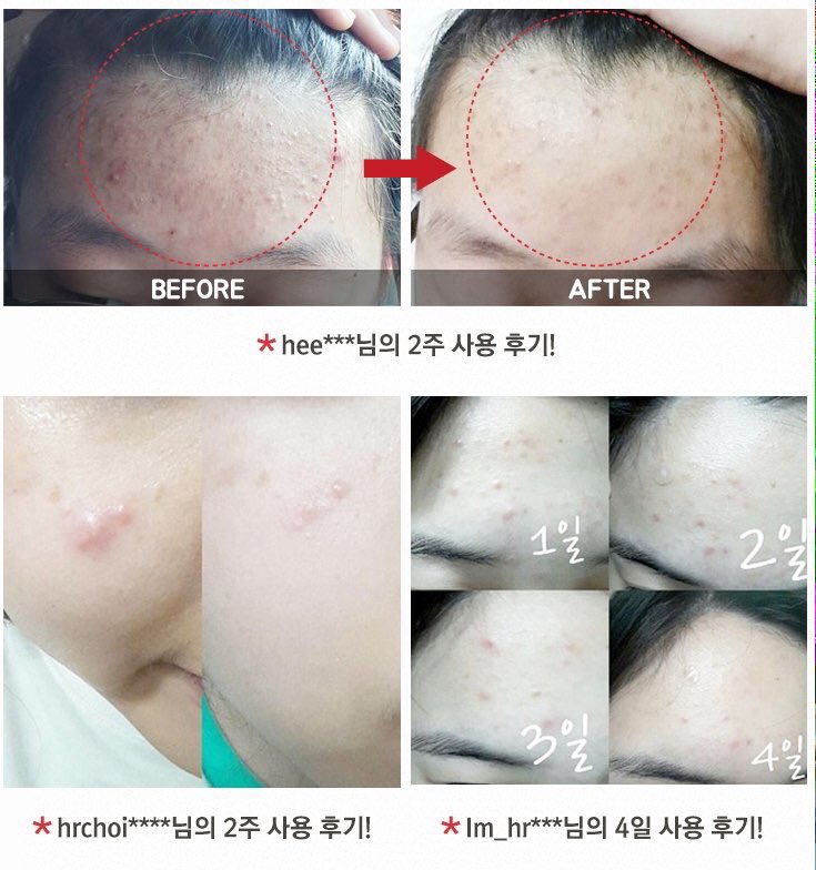 bxbyshp's tweet photo. 🔥HOT SALE🔥⁽PRE⁾ #COSRX ONE STEP PIMPLE CLEAR PAD
จากปกติ750.-
♡⃣PROMOTION 530.-♡⃣ 
:꒰EMS 60 ลทบ.40🌙꒱:
ปิดรับ 23/02 🐰 https://t.co/TqcfxHeY32