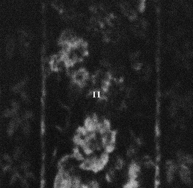 PVRIS Indonesia tweet media