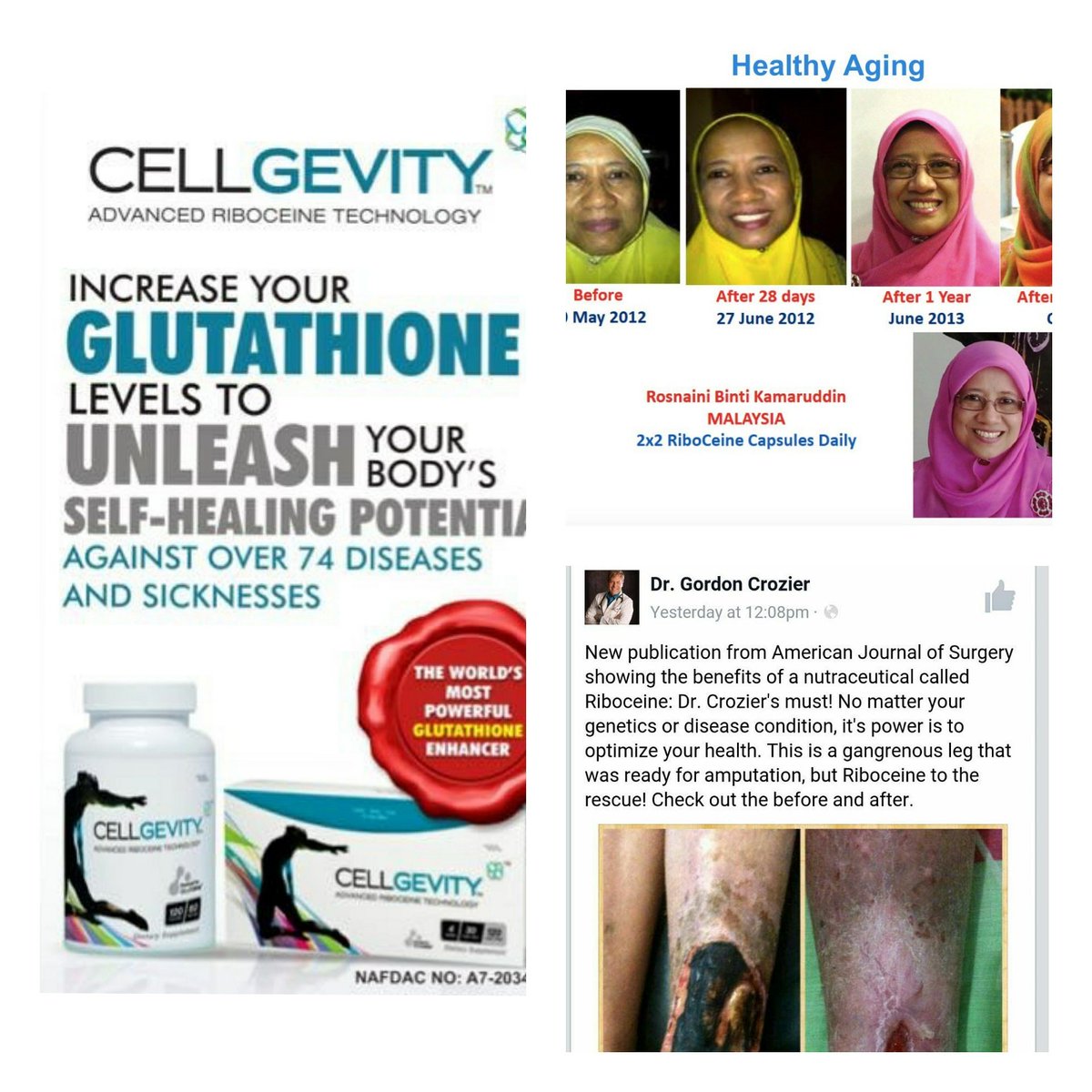 Max_Cellgevity's tweet photo. Be Active, Be Healthy, Be yourself - Think Glutathione. Click https://t.co/0LQp1wJ7wi #Health4AllNaija  #wingstourinseoul  #GRAMMYs https://t.co/yXZ7bf0Tk4