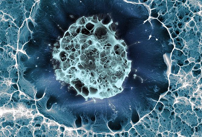 CellPressNews's tweet photo. View this cryogenically frozen #stemcell and other amazing images in the Best of 2016 #CellPictureShow. https://t.co/SUcuUoknIc https://t.co/DIQsdDzUQh