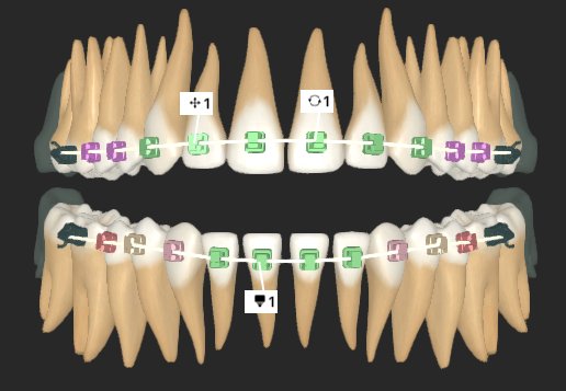 Gain insights on bond failure trends, bracket replacement and repositions and assess end-to-end treatment statistics. #ortho4D #orthodontics