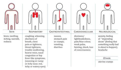 ACParaStudents's tweet photo. Sx of anaphylaxis, for your Teachy Tuesday https://t.co/3LHwdNambw