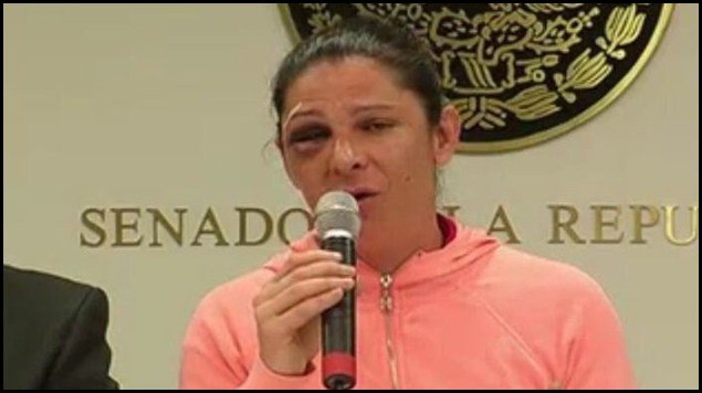 Marurojasreport's tweet photo. AGRESOR DE ANA GUEVARA PIERDE JUICIO DE AMPARO. https://t.co/9rh0fufoUD https://t.co/26dcyX3FAS