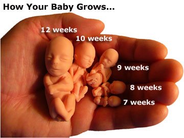 TimBurt's tweet photo. I pray today that all of our nation get a conscience &amp; protect the life of the unborn now!  #RightsOfTheUnborn Deserves endless #retweets https://t.co/ESeRJZEYJL