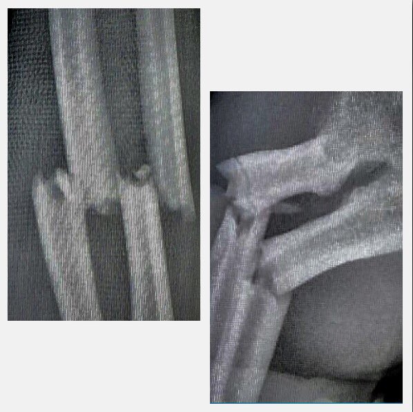 ShrumSusan's tweet image. Texting &amp;amp; driving… break the habit… before it breaks you.