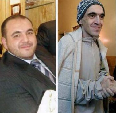 amnestynl's tweet photo. Zo zie je eruit als je één van de 'gelukkigen' bent die de Saydnaya gevangenis heeft overleeft. https://t.co/x2kSWktHnu #beforeafter #syrie https://t.co/YKG1s4ILKn