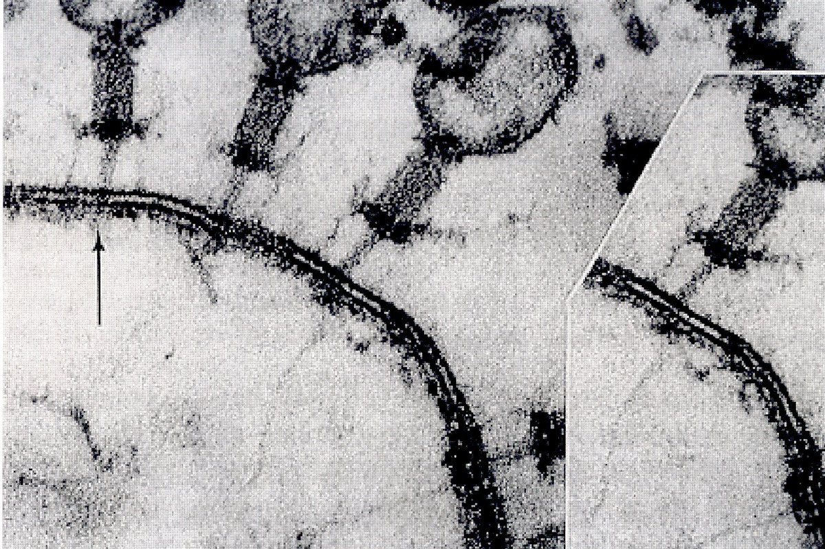 Resultado de imagen de virus al microscopio electronico