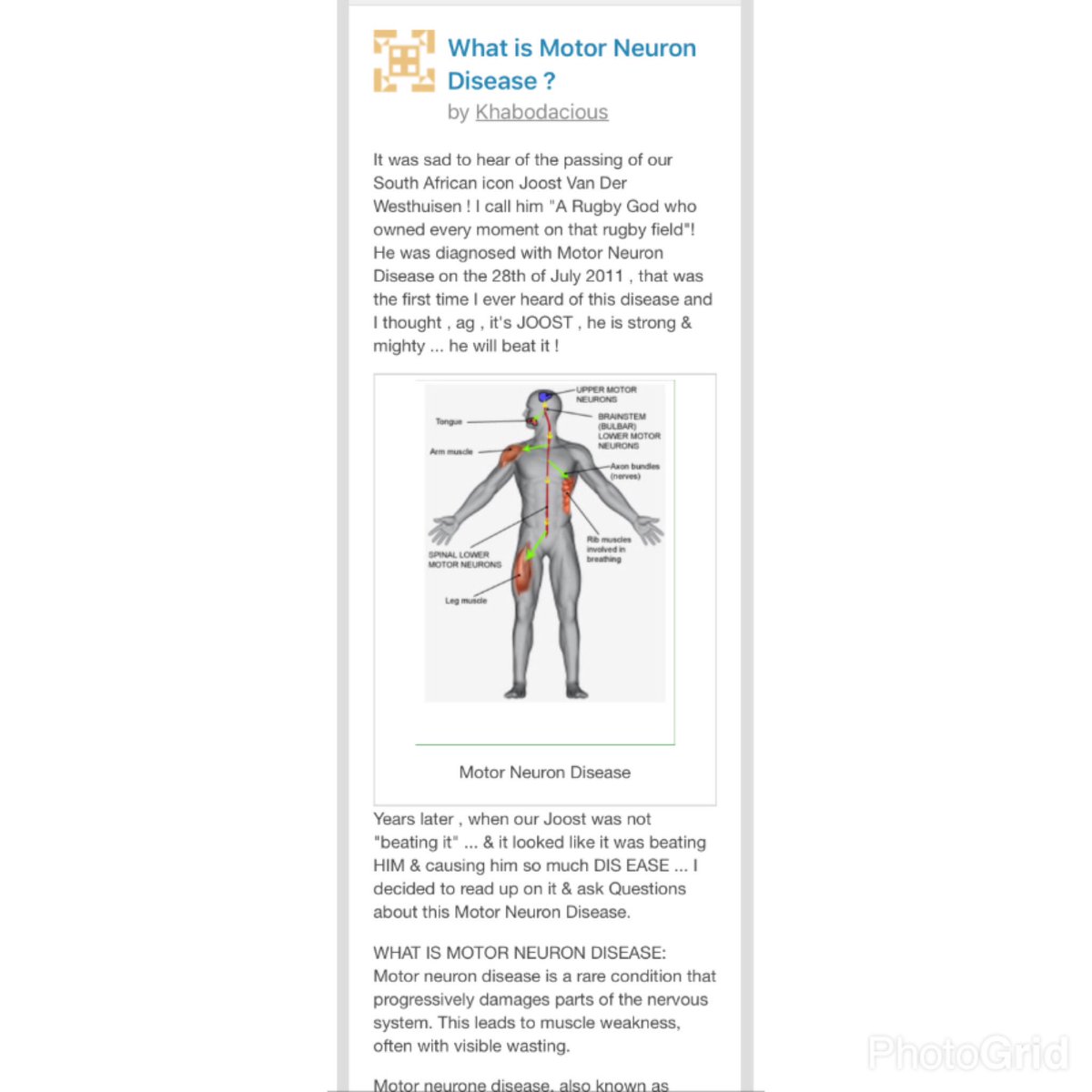 Khabonina_Q's tweet photo. Today's #FitnessTuesday News focused on #MotorNeuronDisease do you know what it is ? Read more about it https://t.co/zMkxM5Vygi #EducateSelf https://t.co/5MBuE0uAh9