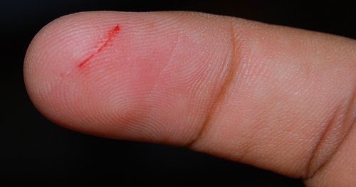 Okudunuz mu? Kağıt kesiği neden daha çok acıtır? dlvr.it/NJtJ6s #7saniye #İlginç_bilgiler