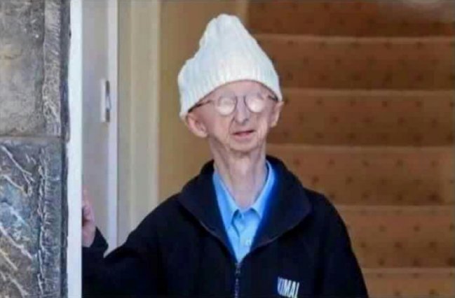 jjam_37's tweet photo. Here's Jonjo the morning after #YedlinsTeaParty https://t.co/9JOrsQrOmU