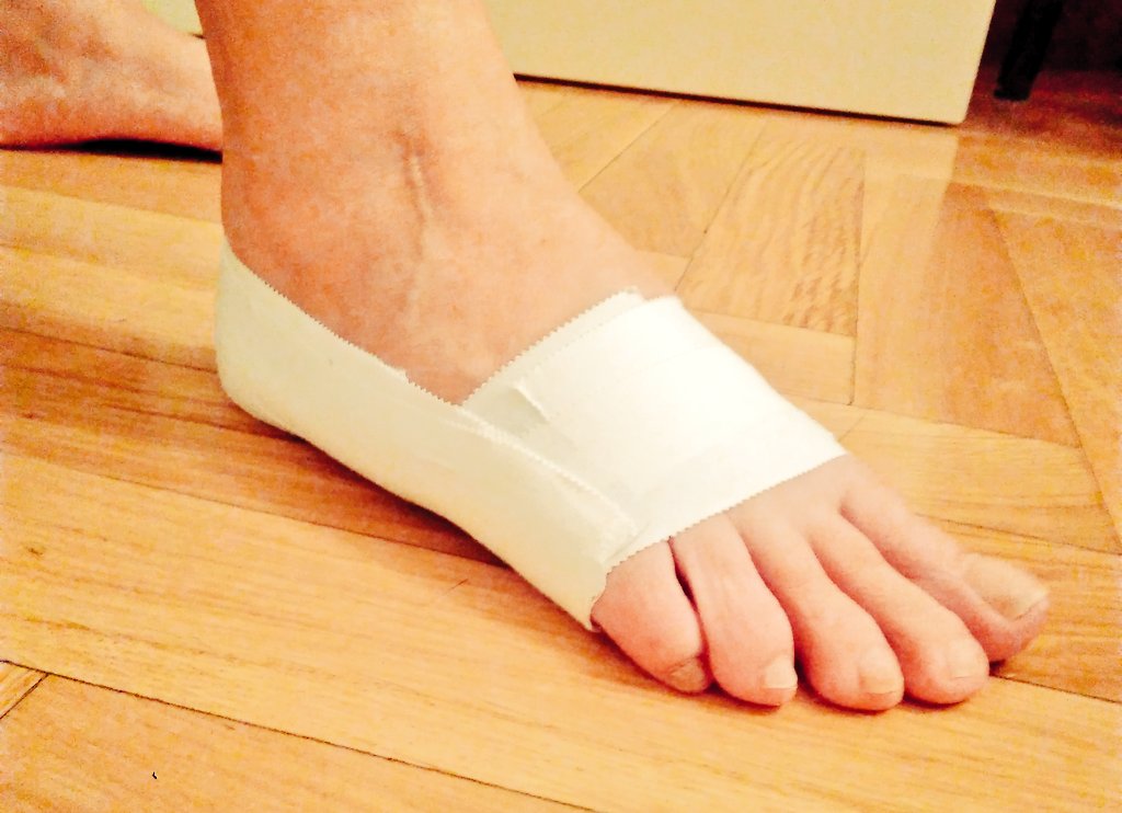 Fisio_Lain's tweet photo. Vendajes funcionales para fascitis plantar! 
Gran eficacia y efecto de analgesia en la marcha. https://t.co/E7vMYXDuB6