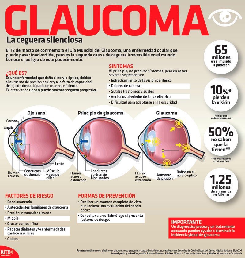 GlaucomaGlobal's tweet photo. Notimex El especialista José Antonio Paczka Zapata exhortó a los adultos mayores a identificar factores de ri... https://t.co/9fzVyWWcLI https://t.co/KwYAXQOtTD
