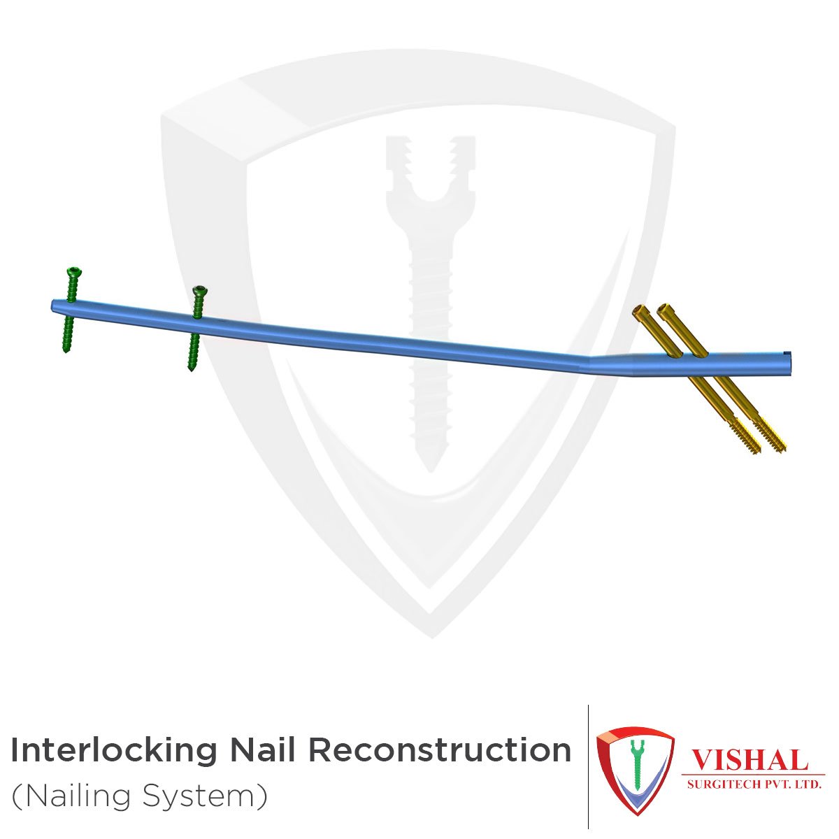 VishalSurgitech's tweet image. Interlocking Nail Reconstruction:
Diameter: Ø 9,10,11,12,13 mm
Specification: 260 to 440 mm (Diff. 20mm)

#VishalSurgitech #NailingSystem