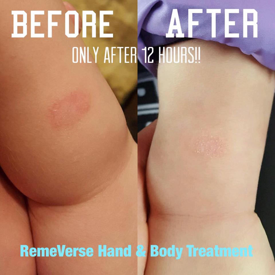 HallyeTerrell's tweet photo. Another happy @RemeVerse customer! Little ones love Hand &amp; Body Treatment - no fragrance, oils, dyes or parabens. https://t.co/Np4k2eigqv https://t.co/I94yiZKrpX