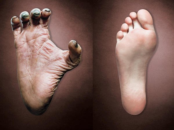 EquipodelaTorre's tweet image. Las “cicatrices de la evolución”: todas aquellas afecciones que padecemos por caminar erguidos quo.es/ciencia/dolore… vía @QuoRevista