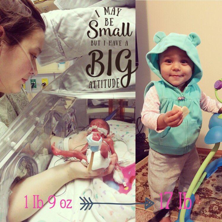 Hayley04458838's tweet photo. @babypicsapp loving the preemie representation. Our soon to be one year old little warrior 👶🏽💪🏼💕 https://t.co/3rLhn6SAoa