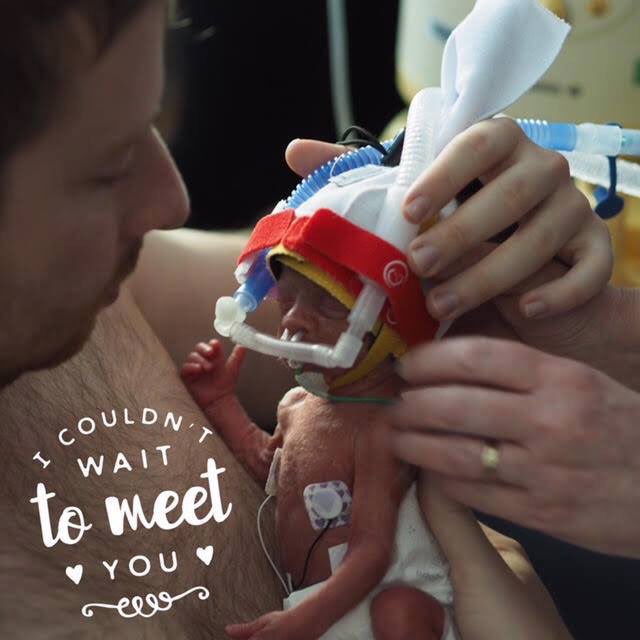 MiracleBabies's tweet photo. Watch the 'Preemie Proud' behind the scenes video https://t.co/lqVM1k0bws created in partnership with @babypicsapp and @babylovenappies https://t.co/o5SwUwr1Ng